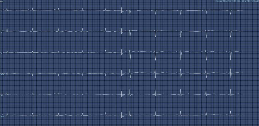 Das ist das Ruhe EKG der Praxis Huntemann, Lüdenscheid