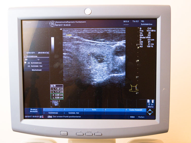 Das ist der Ultraschall ( Sonographie) der Schilddrüse der Praxis Huntemann, Lüdenscheid