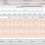 Moderneste Herzdiagnostik mit KI gestütze Auswertung