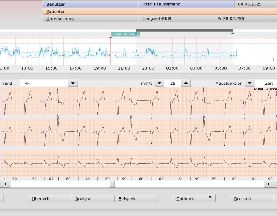 Moderneste Herzdiagnostik mit KI gestütze Auswertung